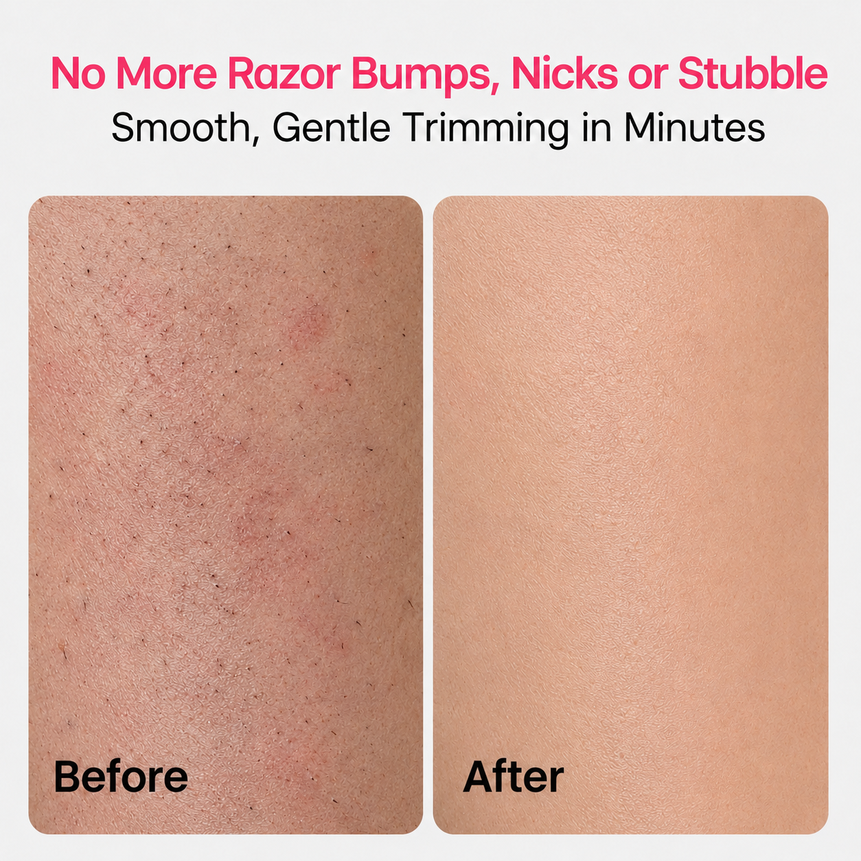 Before and after comparison showing smoother-looking skin after gentle trimming