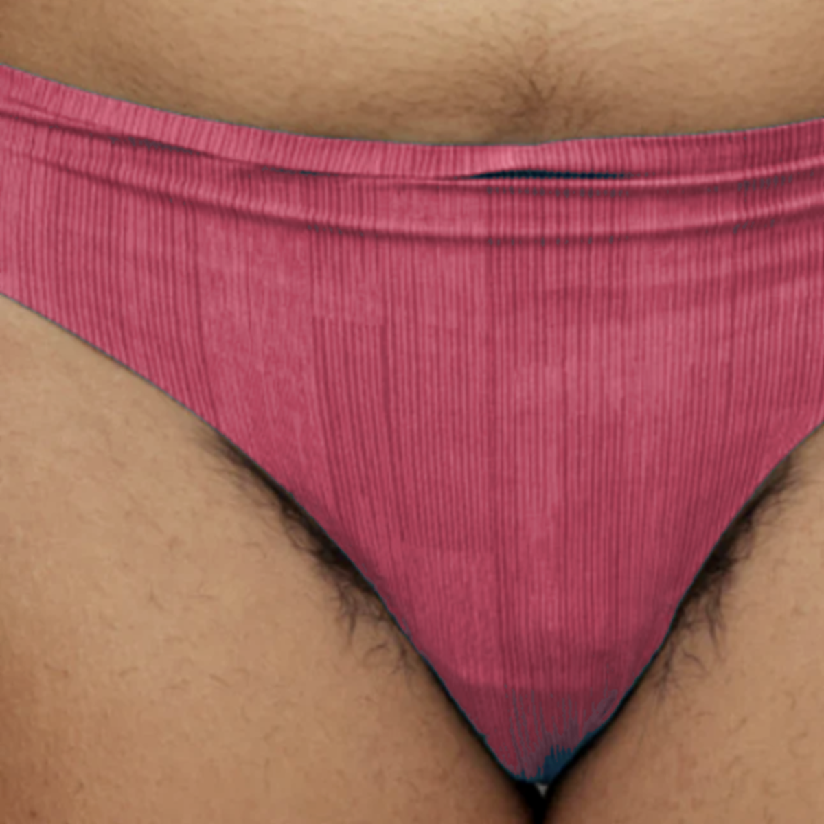 Before Blyra: bikini-line area before trimming, shown in a non-explicit grooming comparison